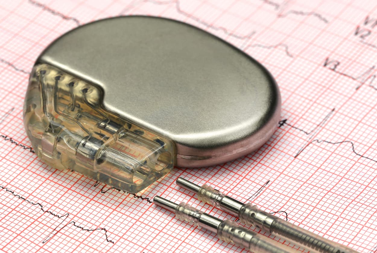 Electrocardiograph with pacemaker stock photo